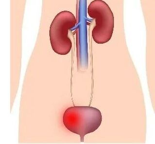 Las razones para el desarrollo de la cistitis en las mujeres
