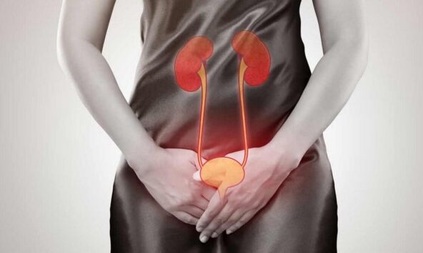 Causas y tratamiento de la cistitis en mujeres