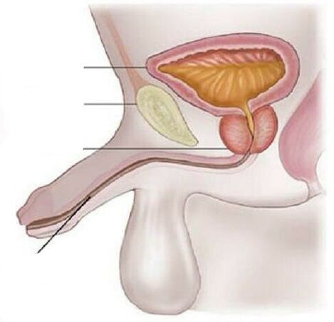 Cistitis en hombres